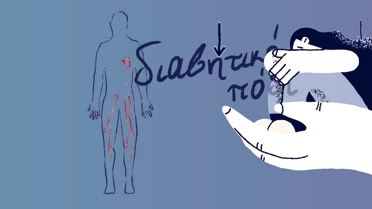 Διαβητικό Πόδι | Δρ. Θεοδόσιος Μπίσδας